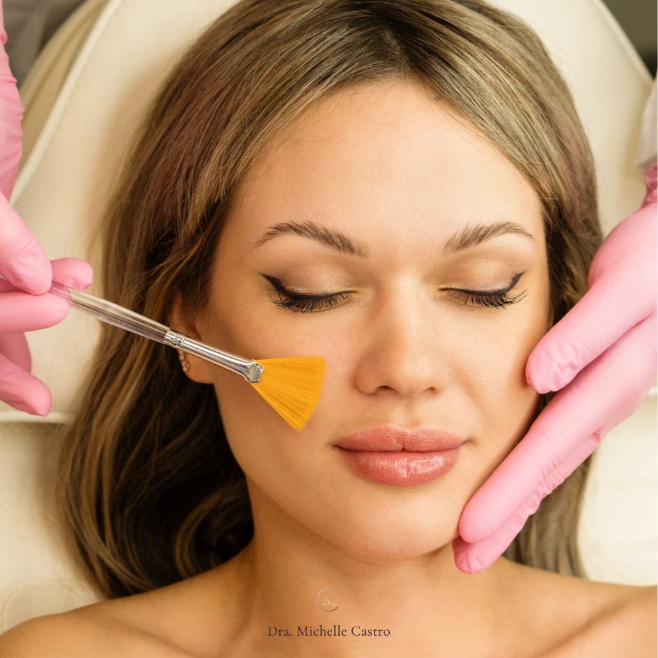Imagem ilustrativa do tratamento Peeling Químico (Gerenciamento de pele)