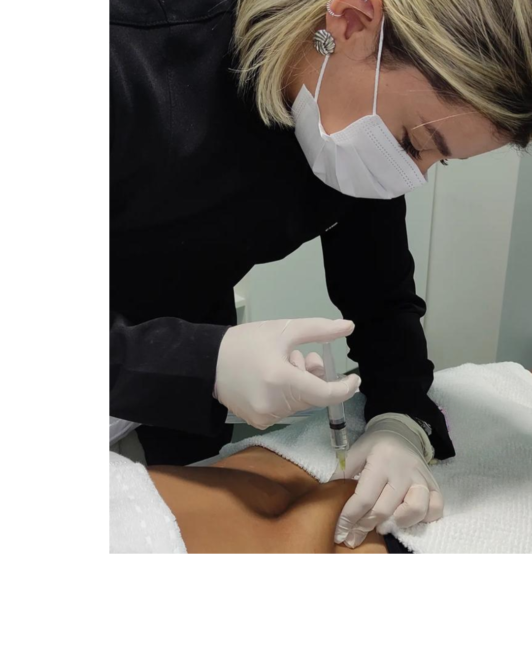 Imagem ilustrativa do tratamento Mesoterapia Corporal (Injetáveis)